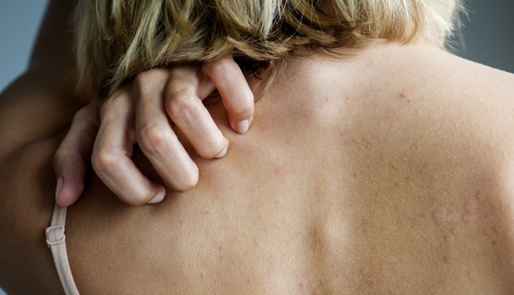 vrouw krabt aan rug