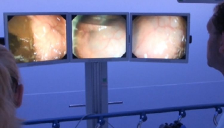 Endoscopie