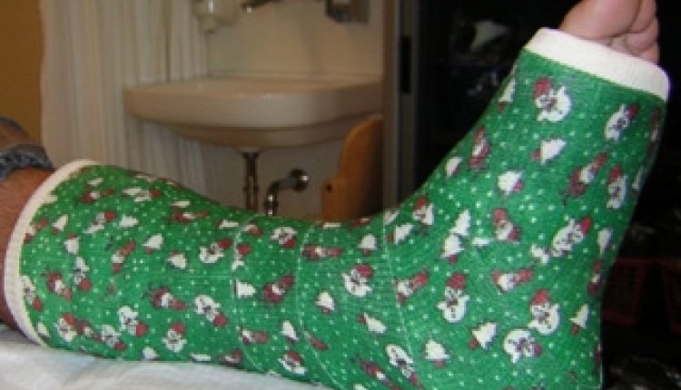 Kerstgips