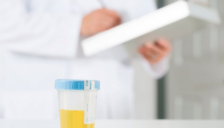 Urine sample