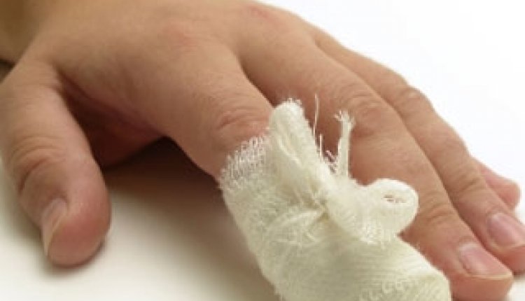 Vinger in verband