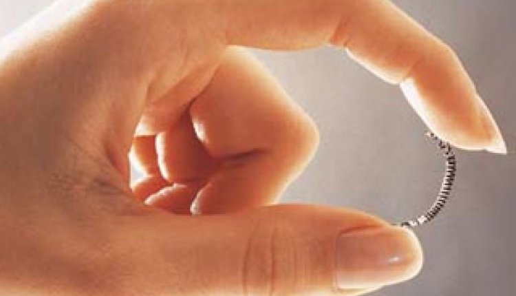 Essure