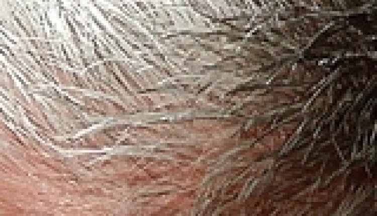 Grijs haar