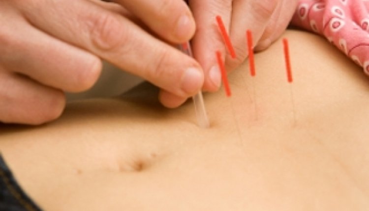 Acupunctuur buik vrouw