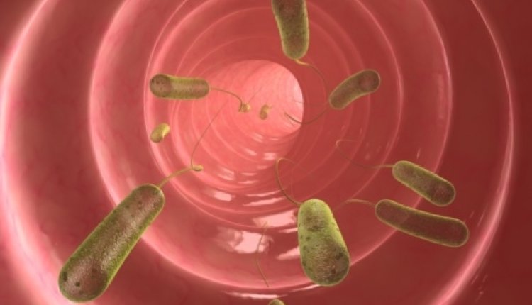 Ecoli