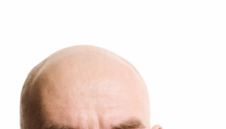 Kaal man