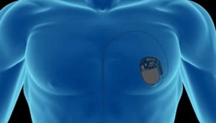 Pacemaker