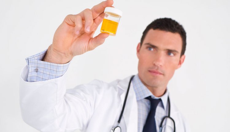 Urinetest