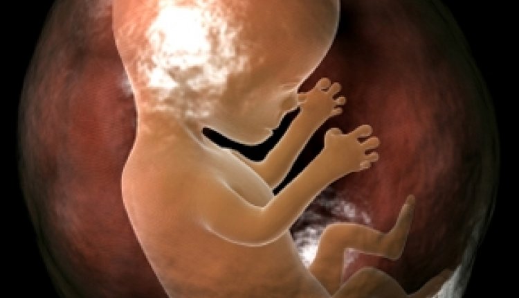 Foetus