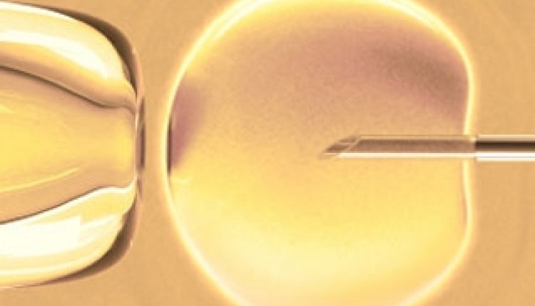 In vitro ivf