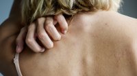 vrouw krabt aan rug