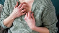 Vrouw heeft last van jeuk en eczeem op haar huid