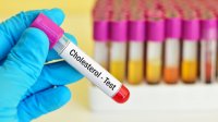 cholesterol-test