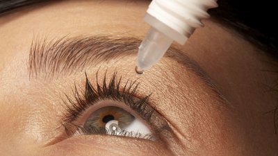 5 vragen over een oogontsteking