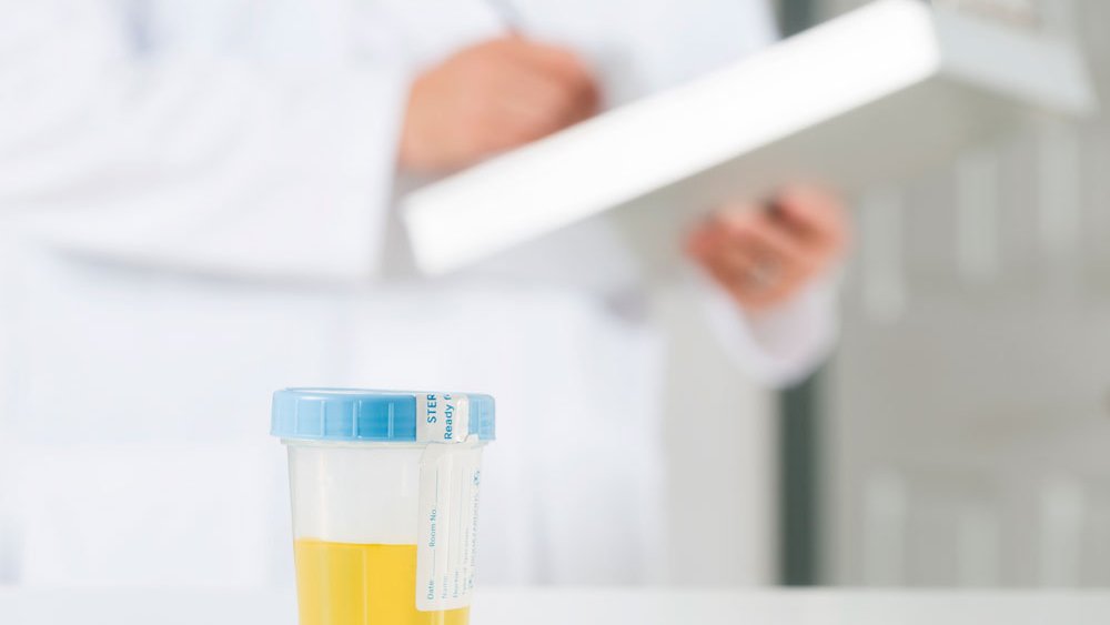 Heb ik een nierbekkenontsteking?