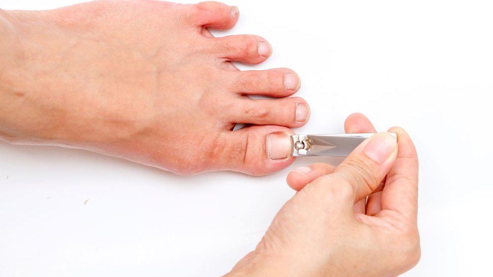 Teennagels de juiste knipmethode