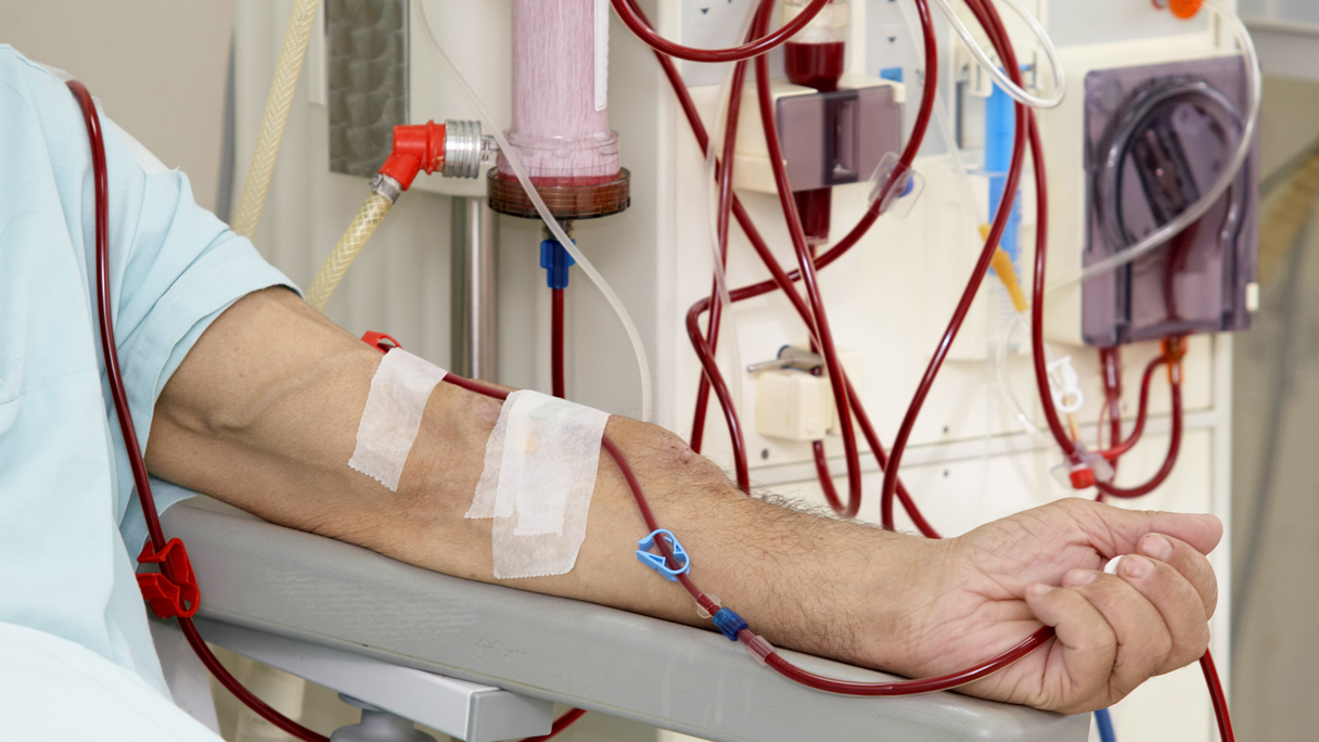 5 Vragen Over Nierdialyse Gezondheidsnet