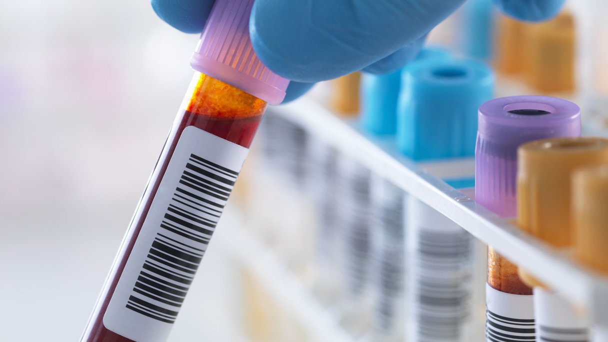 10 vragen over bloedonderzoek | Gezondheidsnet