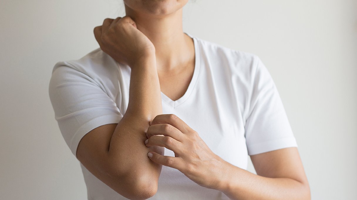 Wat doe je tegen eczeem?