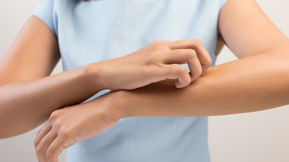 punt veiling Ontwijken Jeuk en pijn bij gordelroos | Gezondheidsnet