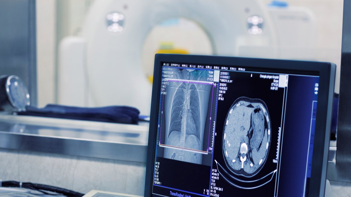 CTscan 'ziet' meer in je lichaam