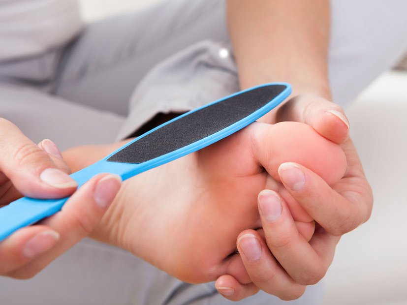 gevoeligheid oosten markering Verwijder je eeltplekken | Gezondheidsnet