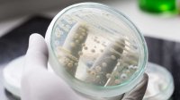Vaginale schimmelinfectie
