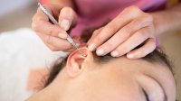 Vrouw ondergaat ooracupunctuur