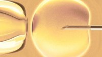 In vitro ivf