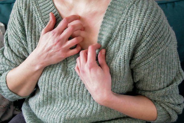 Vrouw heeft last van jeuk en eczeem op haar huid